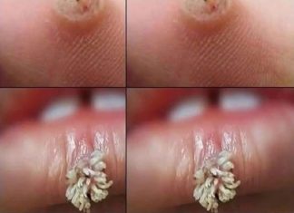 BE VERY CAREFUL . If you get this, you are infected with