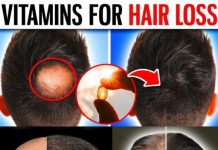 10 POWERFUL Vitamins That Prevent Hair Loss