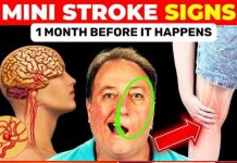 MINI STROKE ALERT! 8 Silent Signs You Shouldn’t Ignore