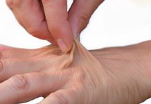 The first sign of dehydration is…