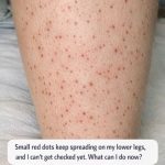 Small red dots keep spreading on my lower legs, and I can’t get checked yet. What can I do now?