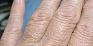 My hands suddenly look thin and crepey in winter, and lotion barely helps. What can I do right now?