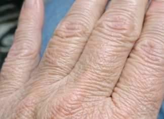 My hands suddenly look thin and crepey in winter, and lotion barely helps. What can I do right now?