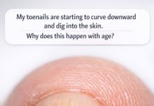 My toenails are starting to curve downward and dig into the skin. Why does this happen with age?
