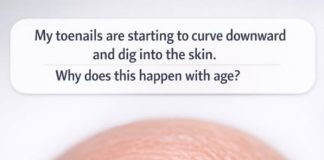 My toenails are starting to curve downward and dig into the skin. Why does this happen with age?