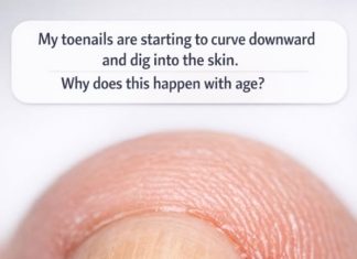 My toenails are starting to curve downward and dig into the skin. Why does this happen with age?
