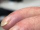 Why Are My Dad’s Fingertips Becoming Rounded and His Nails Curving Over the Edge?