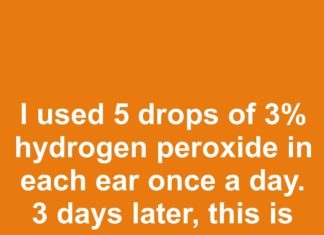 I used 5 drops of 3% hydrogen peroxide in each ear once a day. 3 days later, this is what happened