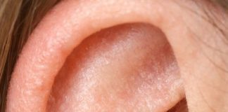 The skin inside my ears keeps drying out and flaking in February. What causes this?