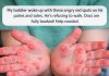 When Your Toddler Wakes Up With Red Spots on Hands and Feet — What It Might Mean