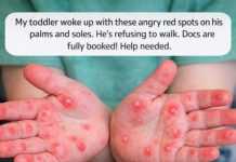 When Your Toddler Wakes Up With Red Spots on Hands and Feet — What It Might Mean