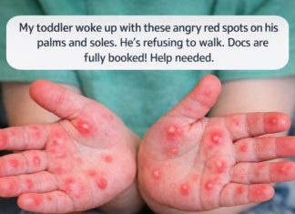 When Your Toddler Wakes Up With Red Spots on Hands and Feet — What It Might Mean