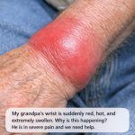 My grandpa’s wrist is suddenly red, hot, and extremely swollen. Why is this happening? He is in severe pain and we need help.