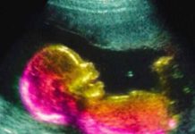 Scientists May Have Actually Found One Of The Causes Of Autism