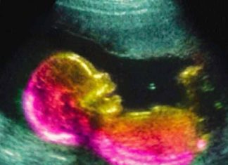 Scientists May Have Actually Found One Of The Causes Of Autism