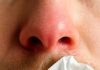 My Nose Keeps Running Indoors During Winter — But I’m Not Sick. What’s Causing It?