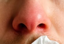 My Nose Keeps Running Indoors During Winter — But I’m Not Sick. What’s Causing It?