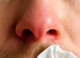 My Nose Keeps Running Indoors During Winter — But I’m Not Sick. What’s Causing It?