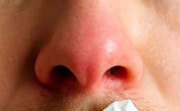 My Nose Keeps Running Indoors During Winter — But I’m Not Sick. What’s Causing It?