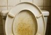 How to Remove Yellow-Brown Stains from a Plastic Toilet Seat (Before You Replace It)