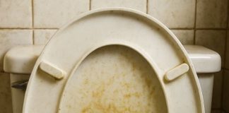 How to Remove Yellow-Brown Stains from a Plastic Toilet Seat (Before You Replace It)