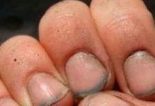 What do you call a person with nails like that?