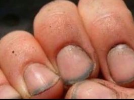 What do you call a person with nails like that?