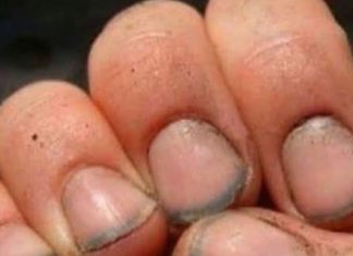 What do you call a person with nails like that?