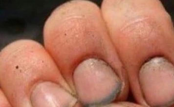 What do you call a person with nails like that?