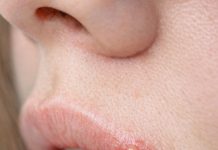 My sister developed this painful bubbling blister on her lip right before her wedding. She is freaking out and needs it gone immediately. Any tips?