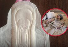 Sanitary Pad Safety: What Women Need to Know to Prevent Infections