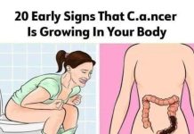 20 subtle can.cer symptoms commonly missed