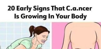 20 subtle can.cer symptoms commonly missed