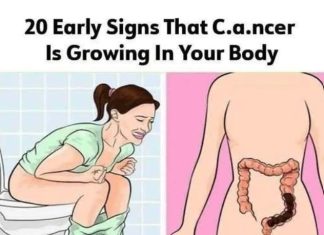 20 subtle can.cer symptoms commonly missed