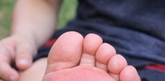 My son stepped on something in the yard and his foot is swelling up so fast. He is crying in pain and I don’t know if I should extract the stinger myself or rush to urgent care. What is this?