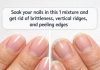 Soak your nails in this 1 mixture and get rid of brittleness, vertical ridges, and peeling edges