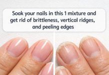 Soak your nails in this 1 mixture and get rid of brittleness, vertical ridges, and peeling edges