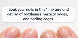 Soak your nails in this 1 mixture and get rid of brittleness, vertical ridges, and peeling edges