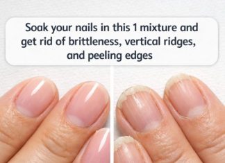Soak your nails in this 1 mixture and get rid of brittleness, vertical ridges, and peeling edges