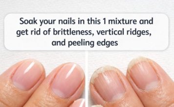 Soak your nails in this 1 mixture and get rid of brittleness, vertical ridges, and peeling edges