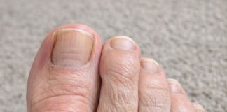 My mom is crying from the pain of this bump on her foot. She can’t even wear shoes and the specialist is booked for weeks. Does anyone have a quick fix?