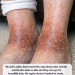 My dad’s ankles have turned this rusty brown color recently and the skin looks so thin and shiny. He says it’s incredibly itchy. His regular doctor is booked for weeks. Any ideas?