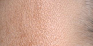 Rub this 1 trick on your neck and get rid of skin tags, dark spots, and raised bumps
