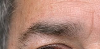 My husband just looked in the mirror and screamed. His eye is full of blood. No pain but it looks severe. Can’t get into the ophthalmologist today. Is this an emergency?