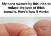 A Simple Home Routine to Improve the Look of Thick Toenails
