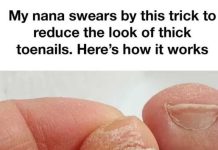 A Simple Home Routine to Improve the Look of Thick Toenails