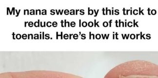 A Simple Home Routine to Improve the Look of Thick Toenails