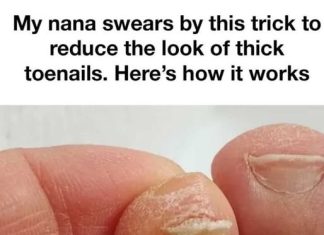 A Simple Home Routine to Improve the Look of Thick Toenails