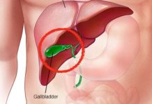 How Does the Body Change After Gallbladder Removal?