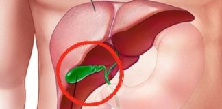 How Does the Body Change After Gallbladder Removal?